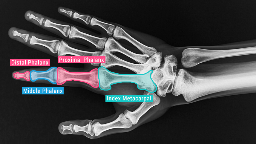 HealthTech - Radiological Annotation to improve AI Model Detection for Surgery